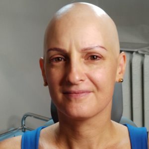 adine_alopecie